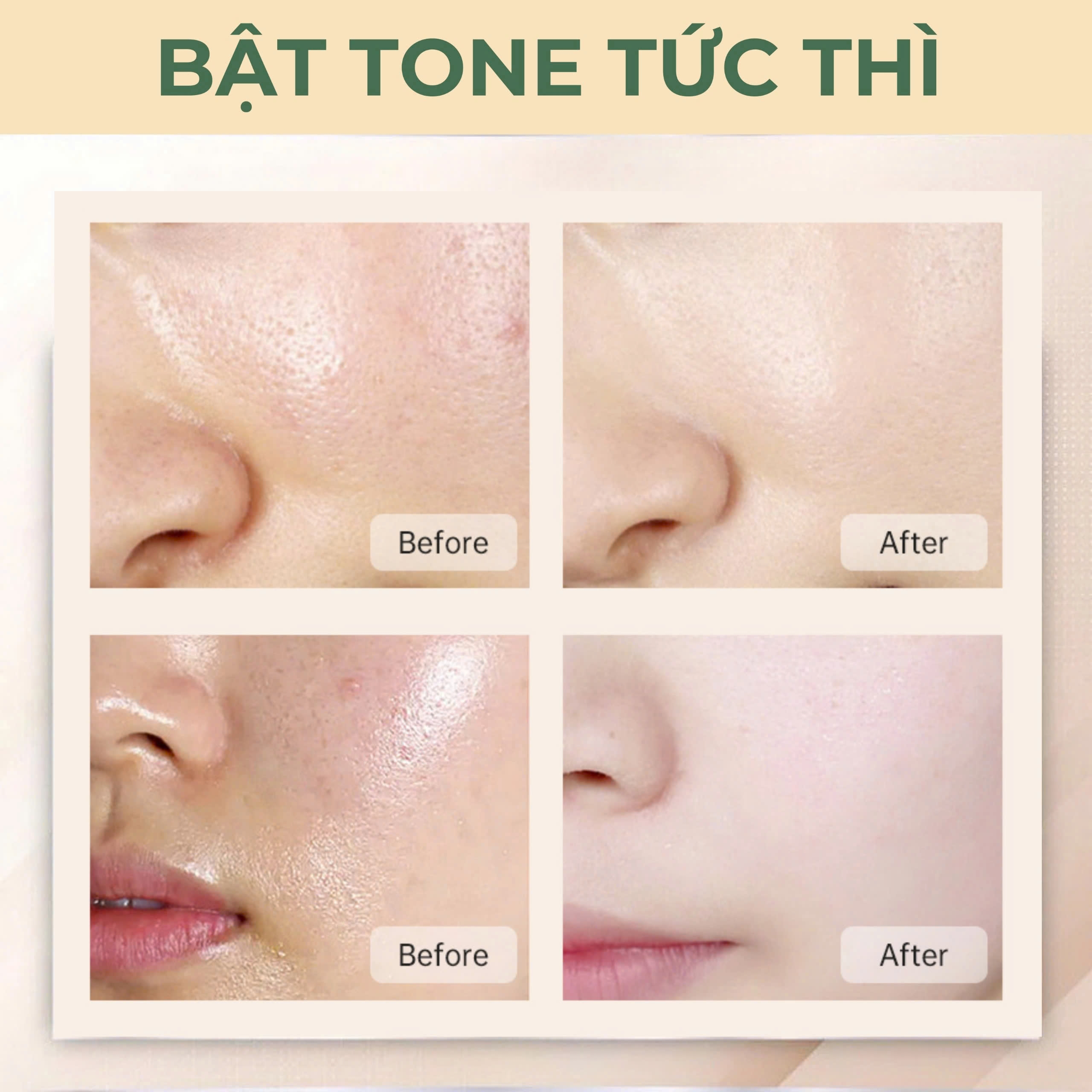 Da trước và sau khi thoa kem nền Calliané One Layer